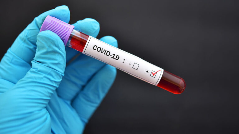 covid-czolo-c